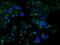 Retinol Dehydrogenase 11 antibody, MA5-25073, Invitrogen Antibodies, Immunocytochemistry image 