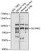 Choline transporter-like protein 2 antibody, LS-C750149, Lifespan Biosciences, Western Blot image 