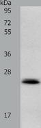 RAB22A, Member RAS Oncogene Family antibody, TA321882, Origene, Western Blot image 