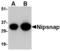 Protein NipSnap homolog 1 antibody, MBS150102, MyBioSource, Western Blot image 