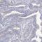 Lebercilin LCA5 antibody, HPA029053, Atlas Antibodies, Immunohistochemistry paraffin image 