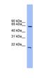 Dachshund Family Transcription Factor 1 antibody, orb330080, Biorbyt, Western Blot image 