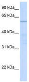 Chromosome 16 Open Reading Frame 71 antibody, TA340327, Origene, Western Blot image 
