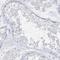 ETHE1 Persulfide Dioxygenase antibody, HPA028360, Atlas Antibodies, Immunohistochemistry frozen image 