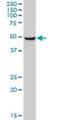 Cytochrome P450 Family 3 Subfamily A Member 43 antibody, H00064816-B01P, Novus Biologicals, Western Blot image 