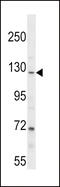 Poly(ADP-ribose) glycohydrolase antibody, 58-669, ProSci, Western Blot image 