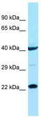 Achaete-Scute Family BHLH Transcription Factor 1 antibody, TA329188, Origene, Western Blot image 