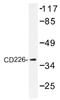 CD226 Molecule antibody, AP01352PU-N, Origene, Western Blot image 