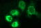 Homocysteine Inducible ER Protein With Ubiquitin Like Domain 1 antibody, LS-C788409, Lifespan Biosciences, Immunofluorescence image 