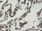 PHD Finger Protein 7 antibody, M13454, Boster Biological Technology, Immunohistochemistry paraffin image 