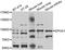 EPH Receptor A1 antibody, A7328, ABclonal Technology, Western Blot image 