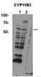 Cytochrome P450 Family 11 Subfamily B Member 2 antibody, TA346195, Origene, Western Blot image 