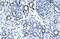Transmembrane Protein 259 antibody, 28-012, ProSci, Enzyme Linked Immunosorbent Assay image 
