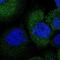Alpha Tubulin Acetyltransferase 1 antibody, NBP2-48990, Novus Biologicals, Immunofluorescence image 