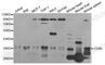 CD86 antibody, A1199, ABclonal Technology, Western Blot image 