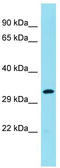R3H domain-containing protein 4 antibody, TA333534, Origene, Western Blot image 