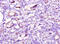 5'-Nucleotidase, Cytosolic IA antibody, LS-C285811, Lifespan Biosciences, Immunohistochemistry paraffin image 