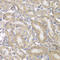 Keratin 17 antibody, LS-C746712, Lifespan Biosciences, Immunohistochemistry paraffin image 