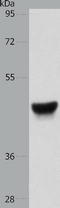 HMW Cytokeratin antibody, TA323035, Origene, Western Blot image 
