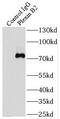 Plexin B2 antibody, FNab06545, FineTest, Immunoprecipitation image 