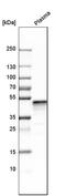 Serpin Family F Member 1 antibody, HPA005825, Atlas Antibodies, Western Blot image 