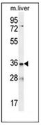 Low Density Lipoprotein Receptor Class A Domain Containing 3 antibody, AP52462PU-N, Origene, Western Blot image 