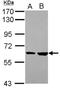 QIP1 antibody, NBP1-31260, Novus Biologicals, Western Blot image 