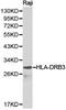 Major Histocompatibility Complex, Class II, DR Beta 3 antibody, PA5-37365, Invitrogen Antibodies, Western Blot image 