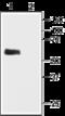Potassium Voltage-Gated Channel Subfamily J Member 3 antibody, GTX54831, GeneTex, Western Blot image 