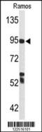 Complement C7 antibody, MBS9202808, MyBioSource, Western Blot image 