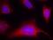 Protein Kinase D1 antibody, GTX50160, GeneTex, Immunofluorescence image 