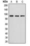 Diacylglycerol kinase beta antibody, LS-C352101, Lifespan Biosciences, Western Blot image 