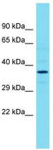 Rho Guanine Nucleotide Exchange Factor 39 antibody, TA333601, Origene, Western Blot image 