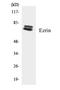 Ezrin antibody, EKC1608, Boster Biological Technology, Western Blot image 