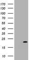 Cyclin Dependent Kinase Inhibitor 2C antibody, TA801187, Origene, Western Blot image 