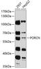 Porcupine O-Acyltransferase antibody, 14-267, ProSci, Western Blot image 