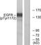 EGFR antibody, TA312532, Origene, Western Blot image 