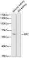 Glycoprotein 2 antibody, 14-422, ProSci, Western Blot image 