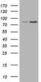 ATP Binding Cassette Subfamily D Member 2 antibody, M02566, Boster Biological Technology, Western Blot image 