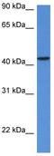 Mevalonate Diphosphate Decarboxylase antibody, TA343105, Origene, Western Blot image 
