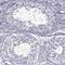 Speedy/RINGO Cell Cycle Regulator Family Member E2 antibody, NBP2-46794, Novus Biologicals, Immunohistochemistry paraffin image 