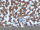 Retinol Binding Protein 1 antibody, NBP2-45017, Novus Biologicals, Immunohistochemistry frozen image 