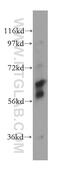 Cocaine esterase antibody, 15378-1-AP, Proteintech Group, Western Blot image 