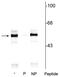Tryptophan Hydroxylase 1 antibody, P01626, Boster Biological Technology, Western Blot image 