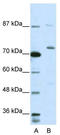 RRP6 antibody, TA345696, Origene, Western Blot image 