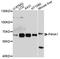 Prolyl 4-hydroxylase subunit alpha-1 antibody, A3999, ABclonal Technology, Western Blot image 
