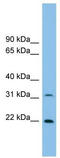 Forkhead Box N2 antibody, TA329632, Origene, Western Blot image 