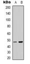 Protein Serine Kinase H1 antibody, LS-C368812, Lifespan Biosciences, Western Blot image 