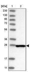 Centromere Protein H antibody, PA5-57687, Invitrogen Antibodies, Western Blot image 