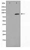 Cyclin Dependent Kinase 11A antibody, TA347695, Origene, Western Blot image 